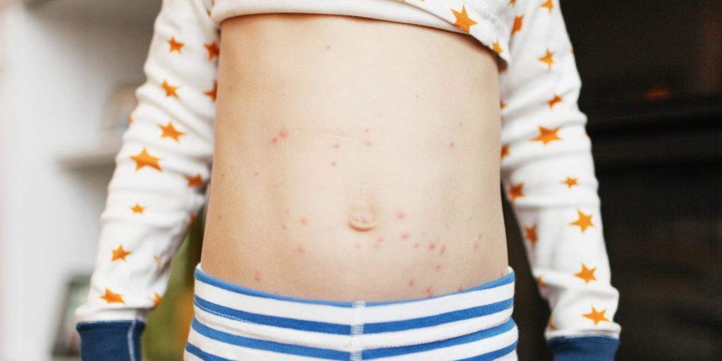 Pediatric Dermatology