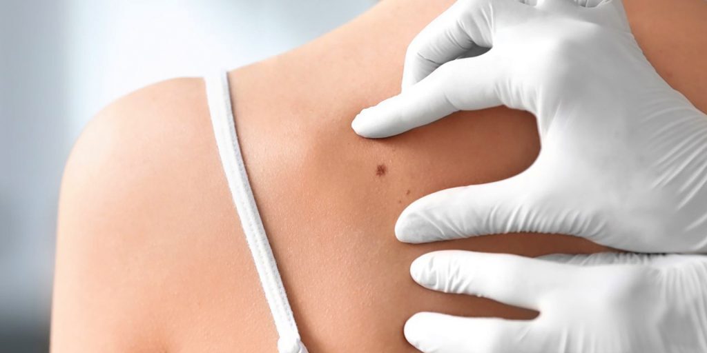 Surgical Dermatology